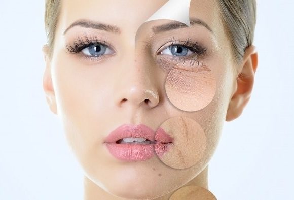 Chemical Peels Chemical Peels